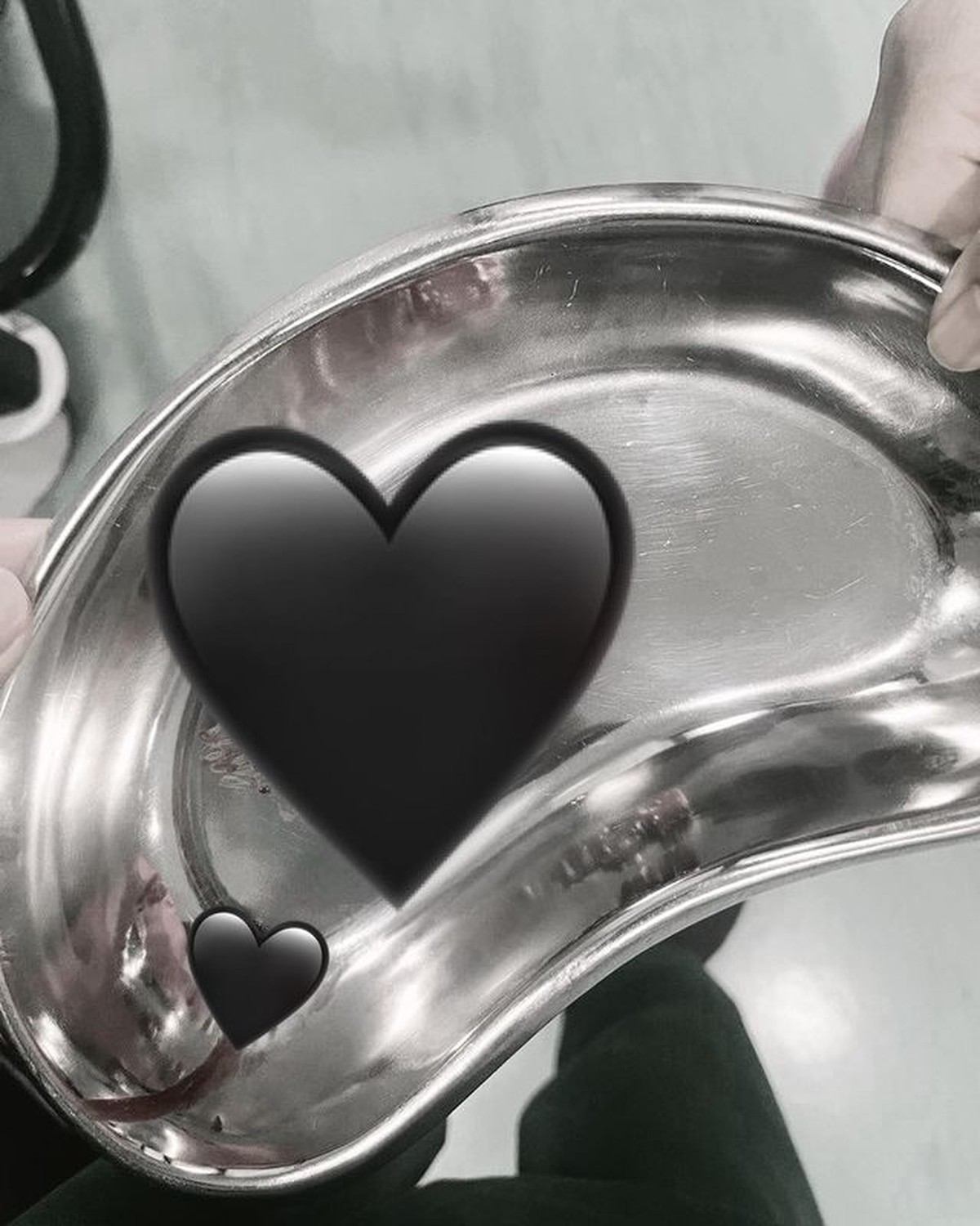 Dinda Hauw keguguran bayi kembar