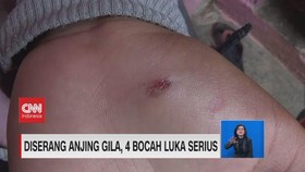 VIDEO: Diserang Anjing Gila, 4 Bocah Luka Serius