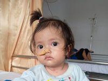 Kelainan Langka, Kulit Bayi Eliza Melepuh Kena Gesekan dan Panas