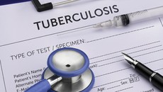 Kasusnya Tinggi di Indonesia, Penularan TBC Terjadi Melalui Apa?