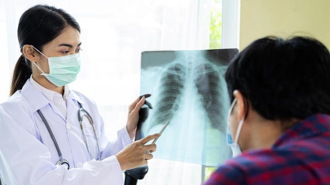 Saat ini tercatat 60 ribu kasus tuberkolosis (TBC) menyerang warga di Jakarta.