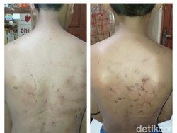 Dalih 5 Senior Tega Aniaya dengan Keji Dua Siswa SMP di Pasuruan