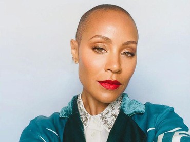 Selain Jada Smith, 5 Artis Indonesia Ini juga Alami Alopecia atau Autoimun