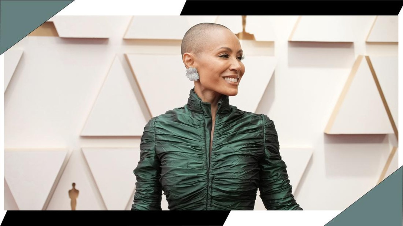 Fakta Tentang Alopecia yang Diidap Jada Smith