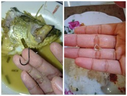 Duh! 5 Netizen Ini Temukan Benda Berbahaya dalam Makanannya