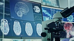 Golongan Darah Ini Disebut Paling Berisiko Terserang Stroke di Usia Muda