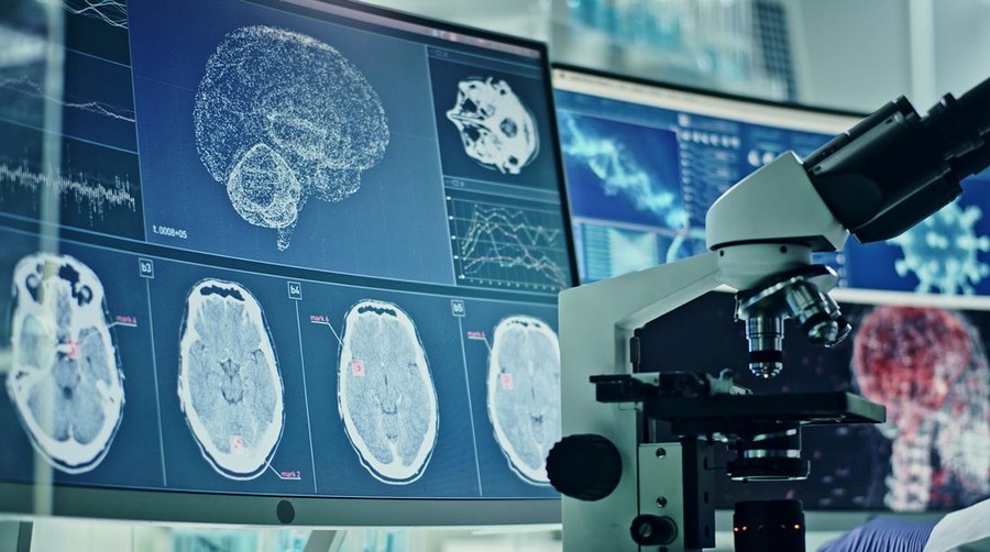 Ilustrasi kerusakan otak Computer screens in laboratory. Brain scans and coronavirus research