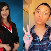 Kisah Perjuangan Natasha Gunther, Perempuan yang Menjalani Hidupnya dengan Separuh Tengkorak