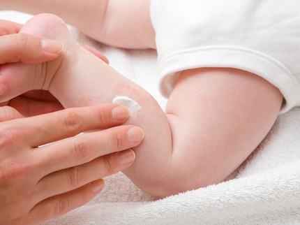 Kenali Gejala dan Penyebab Eksim pada Bayi, Bunda Perlu Tahu