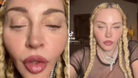 Viral Wajah Aneh Madonna di TikTok Bukan karena Operasi Plastik, Tapi...
