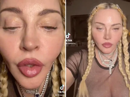 Viral Wajah Aneh Madonna di TikTok Bukan karena Operasi Plastik, Tapi...