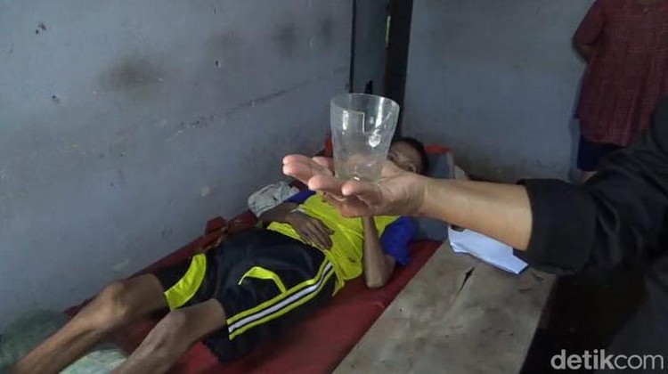 gelas dalam perut pria di jember