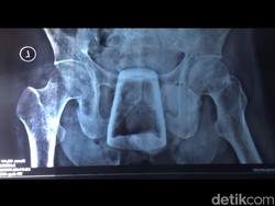 Sebelum Sakit karena Gelas dalam Tubuh, Ini Pekerjaan Nurlasiadi