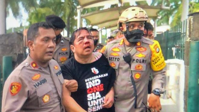Aktivis Pergerakan Indonesia untuk Semua (PIS) Ade Armando babak belur dan berlumuran darah akibat dipukuli massa di kawasan Gedung DPR RI, Senin (11/4).