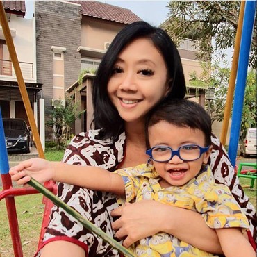 Putra Asri Welas Katarak sejak Usia 3 Bulan, Kini Pakai Kacamata Khusus