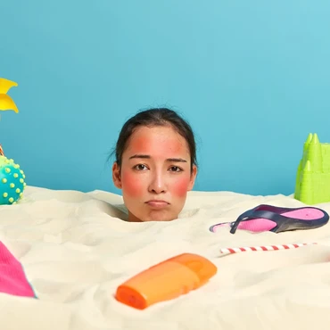 Jangan Sembarangan Atasi Kondisi Kulit Terbakar Matahari, Ini Kata Pakar