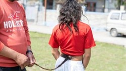 Heboh Remaja 16 Tahun Punya Ekor Bulu 70 Cm
