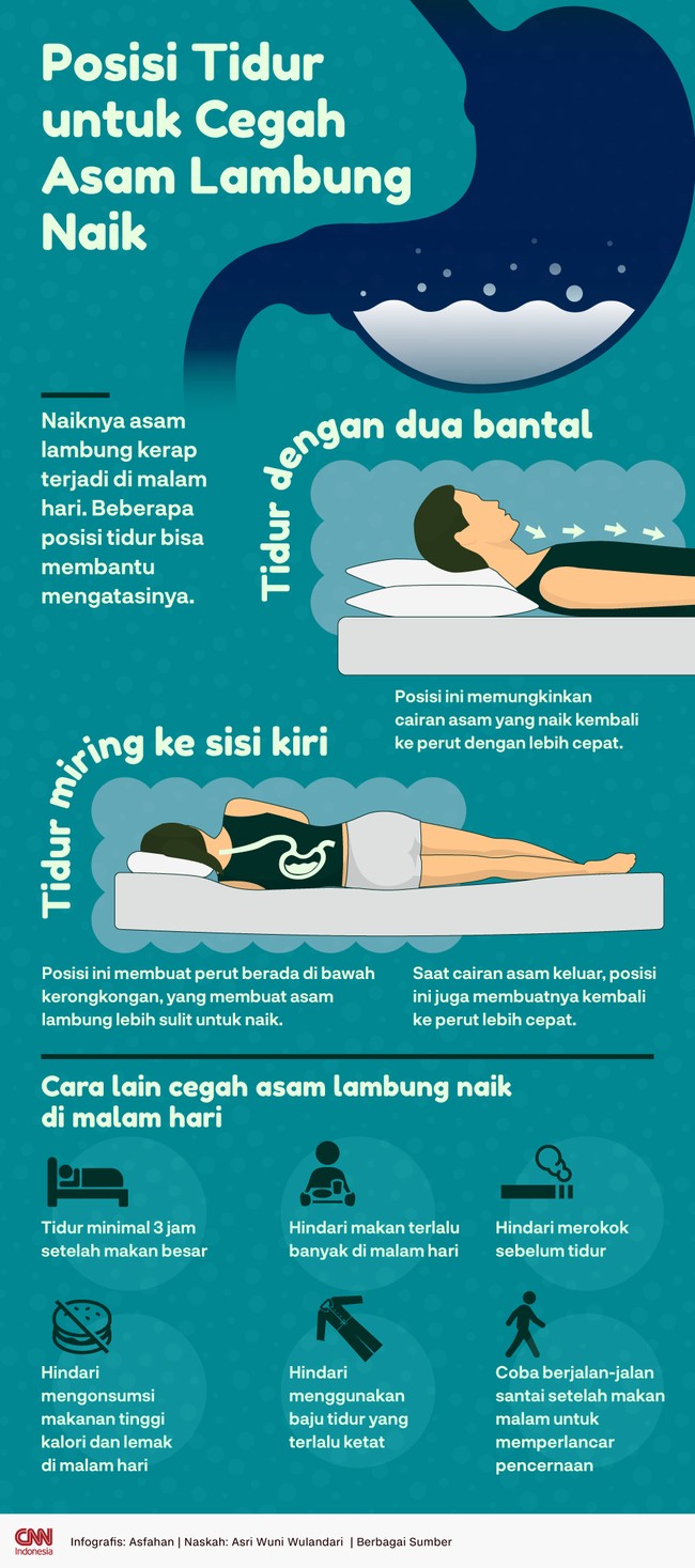 Naiknya asam lambung kerap terjadi di malam hari. Beberapa posisi tidur bisa membantu mencegahnya.