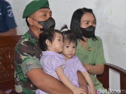 Libatkan 67 Dokter, Balita Kembar Siam di Manado Berhasil Dipisahkan