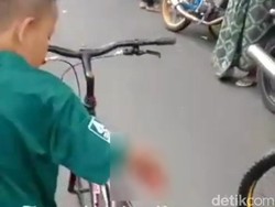 Bocah Korban Ledakan Petasan Kediri Dirawat di RS