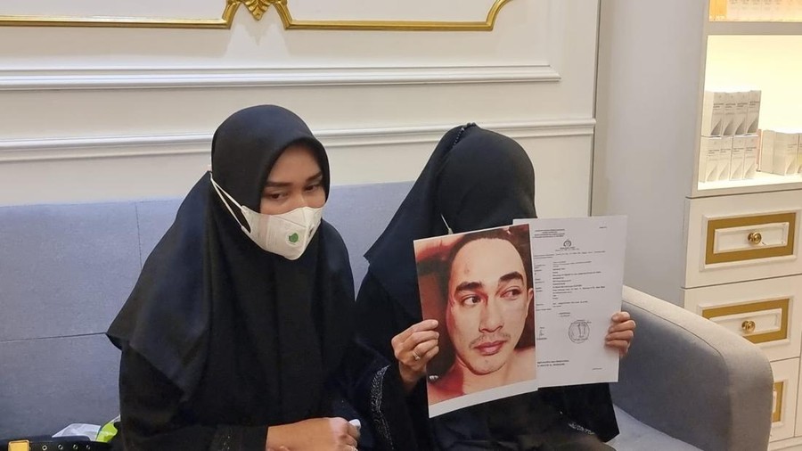 Istri Putra Siregar dan Ibunda Rico Valentino