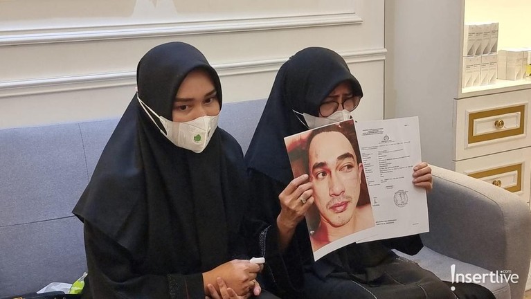 Istri Putra Siregar dan Ibunda Rico Valentino
