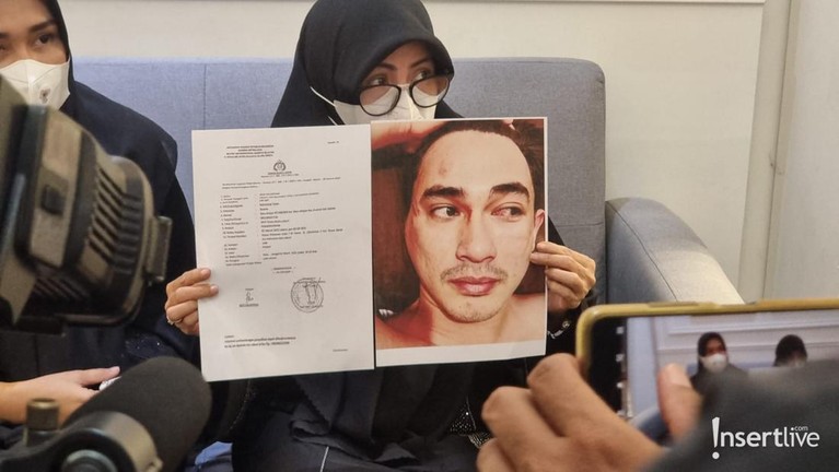 Istri Putra Siregar dan Ibunda Rico Valentino Istri Putra Siregar dan Ibunda Rico Valentino