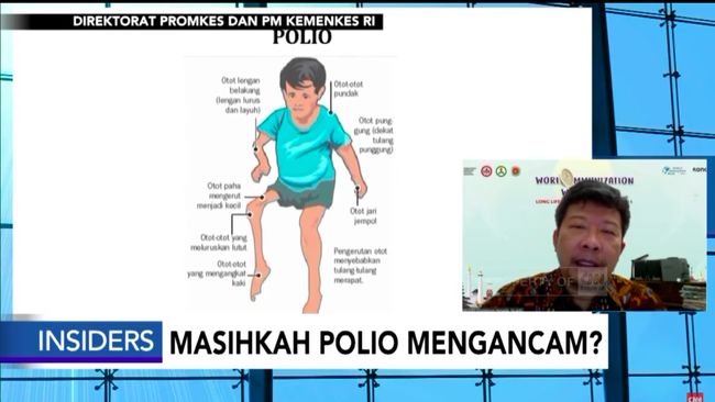 Cara terbaik mencegah polio adalah dengan pemahaman sejak dini mengenai karakteristik penyakit polio, serta cakupan vaksinasi polio.