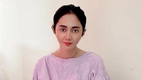 Cerita Aida Saskia Melawan Kanker Payudara