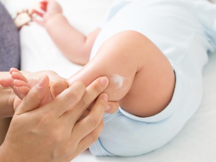 10 Cream untuk Menghilangkan Ruam dan Bintik Merah pada Bayi, Pilih yang Aman Bun!