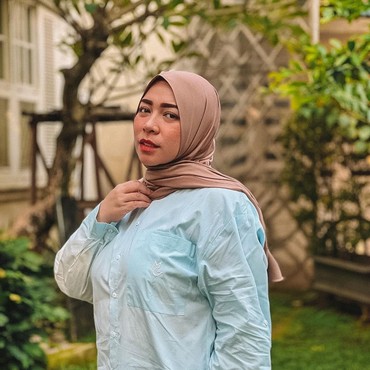 Melly Goeslaw Ungkap Cerita Lucu usai Operasi Bariatrik