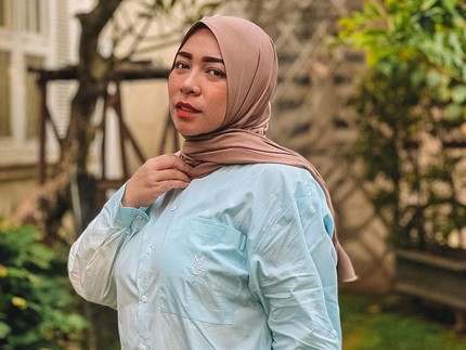 Melly Goeslaw Jalani Operasi Bariatrik Demi Turunkan Berat Badan, Begini Kondisinya Sekarang
