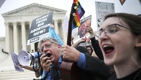 Awal Mula Riuh Aborsi di Amerika Serikat hingga Picu Demo Besar