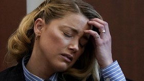 Amber Heard Mengaku Tak Tahu Jari Johnny Depp Putus