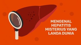 INFOGRAFIS: Mengenal Hepatitis Misterius yang Landa Dunia