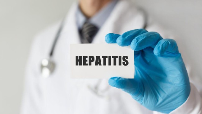 Munculnya kasus hepatitis akut misterius di Indonesia menimbulkan kekhawatiran. Agar tidak panik dan tetap waspada, orang tua perlu tahu beberapa hal berikut.