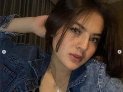 Iqlima Kim Sedot Lemak di Tangan dan Pipi demi Mempercantik Diri