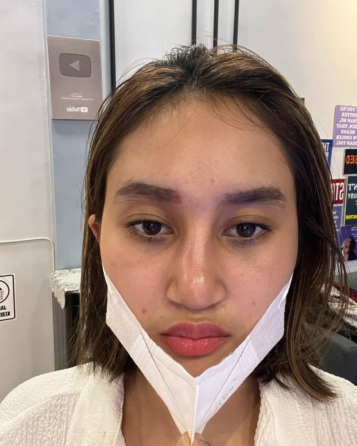 Potret Anak Farida Nurhan Alami Infeksi Implan Hidung Usai Oplas