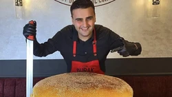 Koki Viral Asal Turki Chef CZN Burak Idap Tumor Otak?
