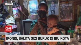 VIDEO: Ironis, Balita Gizi Buruk di Ibu Kota