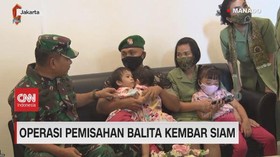 VIDEO: Operasi Pemisahan Balita Kembar Siam