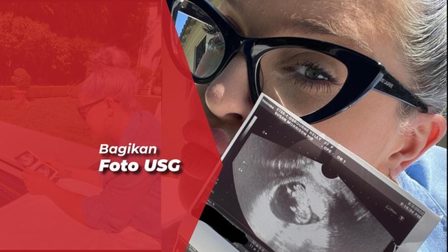 Kelly Osbourne Umumkan Hamil Anak Sid Wilson Slipknot