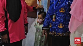 Dinkes DKI Pernah Temukan 49 Pasien Diduga Hepatitis Misterius