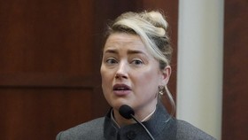 Amber Heard Tak Lakukan Visum Soal Klaim Botol di Organ Intim