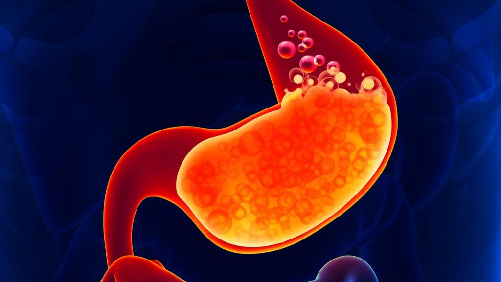 Jarang Disadari, 5 Kebiasaan Ini Pemicu Asam Lambung Naik