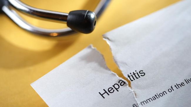 Seluruh kasus hepatitis akut di Indonesia ditemukan terjadi pada kelompok anak. Bagaimana dengan orang dewasa?