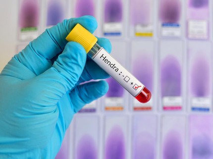Sebabkan 7 dari 10 Orang Meninggal, Ahli Sebut Virus Hendra Berpotensi Jadi Pandemi