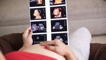 USG FETOMATERNAL UNTUK BUNDA BERUSIA DI ATAS 35 TAHUN