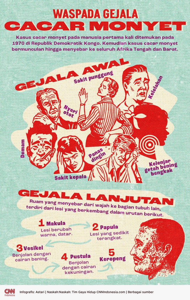 Kasus cacar monyet pada manusia pertama kali ditemukan pada 1970 di Republik Demokratik Kongo. Berikut gejalanya.