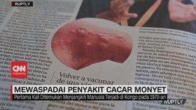 VIDEO: Mewaspadai Penyakit Cacar Monyet